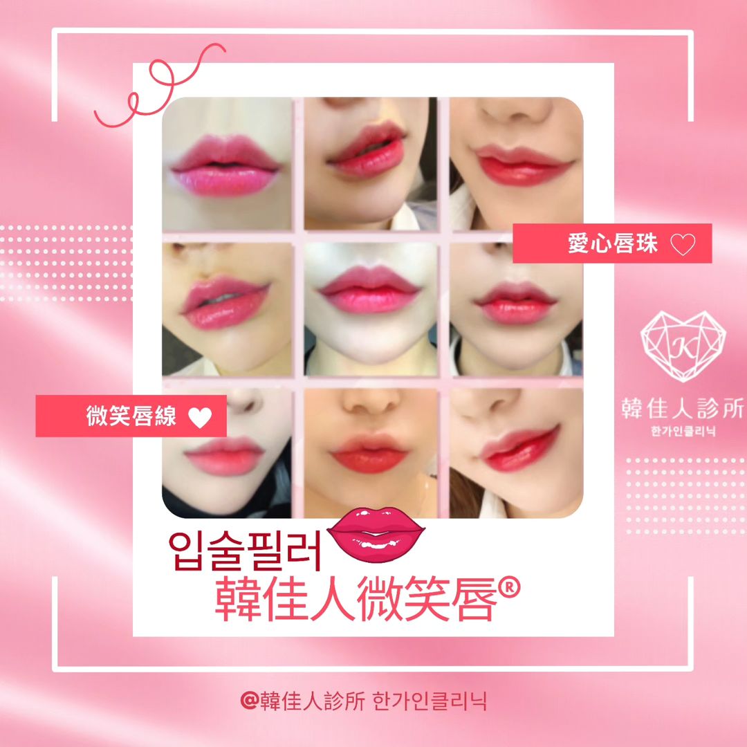 韓佳人傳說中的經典療程🔹微笑唇💋
